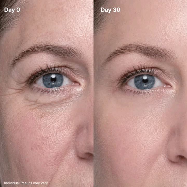 🔥 50% OFF Ends in 2 Hours ⏳ Brighter, Smoother Eye Area ✨